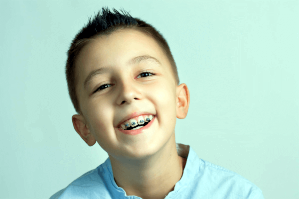 Kids Dental Braces Sowmya Dental Clinic Guntur